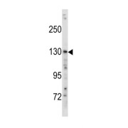 Hamartin (TSC1) Antibody