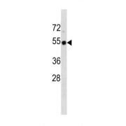 Cellular Tumor Antigen P53 (TP53) Antibody