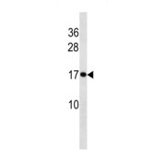 HIST1H3 / 2H3 / 3H3 / H3F3 Antibody