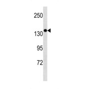 Small G Protein Signaling Modulator 1 (SGSM1) Antibody