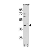 Serine/Threonine Kinase 25 (STK25) Antibody