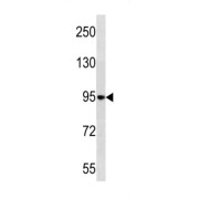 Protein Kinase C-Binding Protein NELL1 (NELL1) Antibody