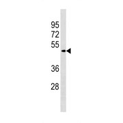 Zinc Finger And BTB Domain-Containing Protein 8A (ZBTB8A) Antibody