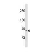 Ribosomal Protein S6 Kinase A4 (RPS6KA4) Antibody