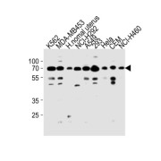 Poly ADP Ribose Polymerase 3 (PARP3) Antibody