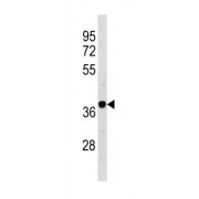 Calcium/Calmodulin Dependent Protein Kinase Type 1D (Camk1d) Antibody