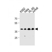 Trans-2-Enoyl-CoA Reductase, Mitochondrial (MECR) Antibody