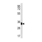 Thioredoxin-Related Transmembrane Protein 1 (TMX1) Antibody