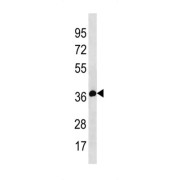 ETS Variant 7 (ETV7) Antibody