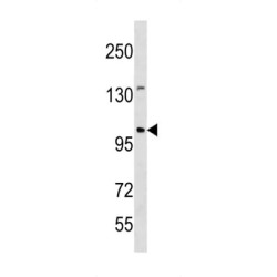 N-Acetyltransferase ESCO1 (ESCO1) Antibody