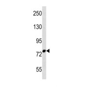 F-Box Protein 43 (FBXO43) Antibody