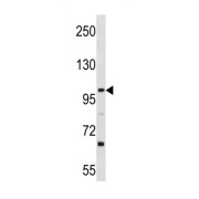 Lethal(3)malignant Brain Tumor-Like Protein 3 (L3MBTL3) Antibody
