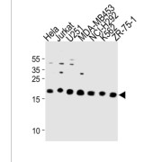 Peptidyl-tRNA Hydrolase ICT1, Mitochondrial (ICT1) Antibody