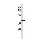 Zinc Finger Protein 92 (ZFP92) Antibody