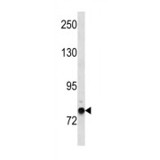 Zinc Finger Protein 12 (ZNF12) Antibody