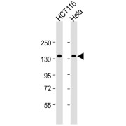 WB analysis of HCT116 and HeLa whole cell lysates (20 µg per lane), using Ankyrin Repeat And SAM Domain-Containing Protein 1A (ANKS1A) antibody (1/2000 dilution) followed by a peroxidase-conjugated Goat anti-Rabbit IgG H&L antibody (1/10000 dilution). Calculated MW: 123 kDa.