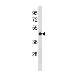 Olfactomedin 3 (OLFM3) Antibody