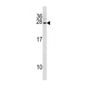Interferon Alpha 8 (IFNA8) Antibody