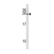 abx034746
