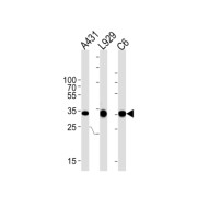 Cyclin D1 (CCND1) Antibody