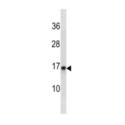 Proteasome Maturation Protein (POMP) Antibody