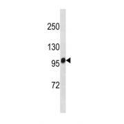 Breast Cancer Anti-Estrogen Resistance Protein 1 (Bcar1) Antibody