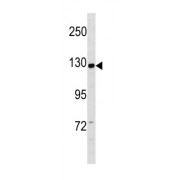Coiled-Coil Domain-Containing Protein 14 (CCD14) Antibody