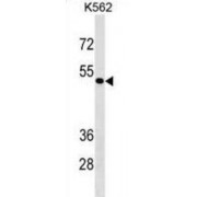 Zinc Finger Protein 733 (ZNF733) Antibody