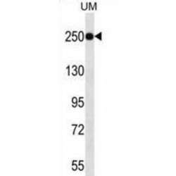 Jumonji/ARID Domain-Containing Protein 1A (JARID1A) Antibody
