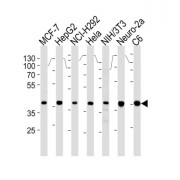Mitogen-Activated Protein Kinase 1 / ERK2 (MAPK1) Antibody