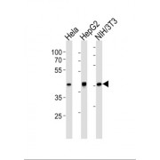 TATA Box Binding Protein (TBP) Antibody