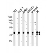 Mitogen-Activated Protein Kinase 1 and 3 / ERK1/2 (MAPK1/MAPK3) Antibody
