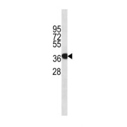 Annexin A1 (ANXA1) Antibody