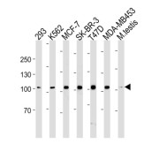 Angiotensin-Converting Enzyme 2 (ACE2) Antibody