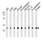 Phosphatidylinositol Transfer Protein Alpha (PITPNA) Antibody