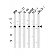 U2 Small Nuclear Ribonucleoprotein Auxiliary Factor 35 kDa Subunit-Related Protein 2 (ZRSR2) Antibody