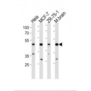 F-Box Protein 28 (FBXO28) Antibody