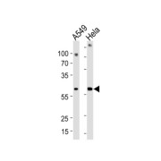 Family With Sequence Similarity 50 Member A (FAM50A) Antibody