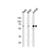 Histone Deacetylase 1 (HDAC1) Antibody