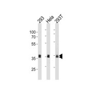 abx034836