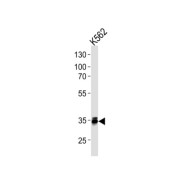 Methyl-CpG Binding Domain Protein 3 (MBD3) Antibody