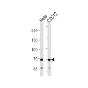 Succinate Dehydrogenase Complex Subunit A (SDHA) Antibody