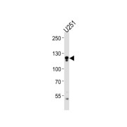 Endothelin Converting Enzyme 2 (ECE2) Antibody