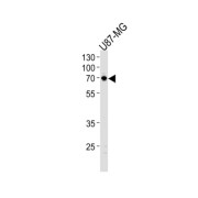 Netrin 1 (NTN1) Antibody