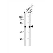SAP30-Binding Protein (SAP30BP) Antibody