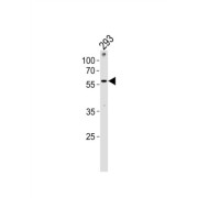 Zinc Finger Protein 76 (ZNF76) Antibody