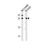 RAB3C, Member RAS Oncogene Family (RAB3C) Antibody