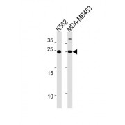 WB analysis of K562 and MDA-MB453 cell line lysates (35 µg/lane), using SSPN antibody.