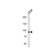 Matrilin 2 (MATN2) Antibody
