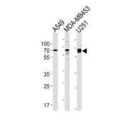 Growth Factor Receptor Bound Protein 10 (GRB10) Antibody